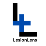 Lesion Lens Logo